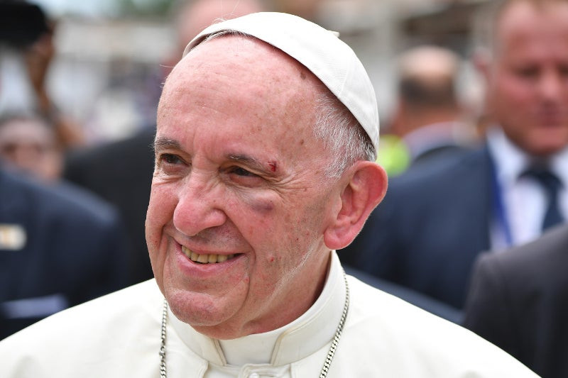 Επεσε και χτύπησε ο πάπας Φραγκίσκος -Τραυματίστηκε στο κεφάλι και το μάτι (εικόνες)